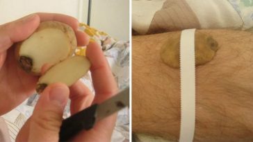 Bizarre Home Remedies