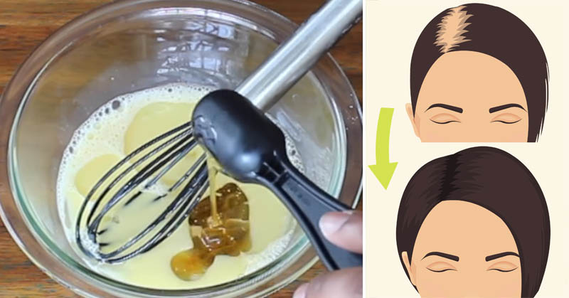 You are currently viewing Mix These 3 Ingredients To Regrow Thick, Strong Hair In No Time!