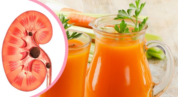 You are currently viewing These Are The 3 Effective Juices That Can Cleanse Your Kidneys According To Recent Research