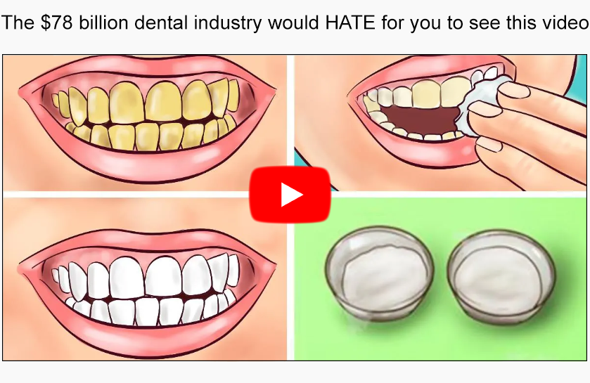 Video for Whitening Your Teeth