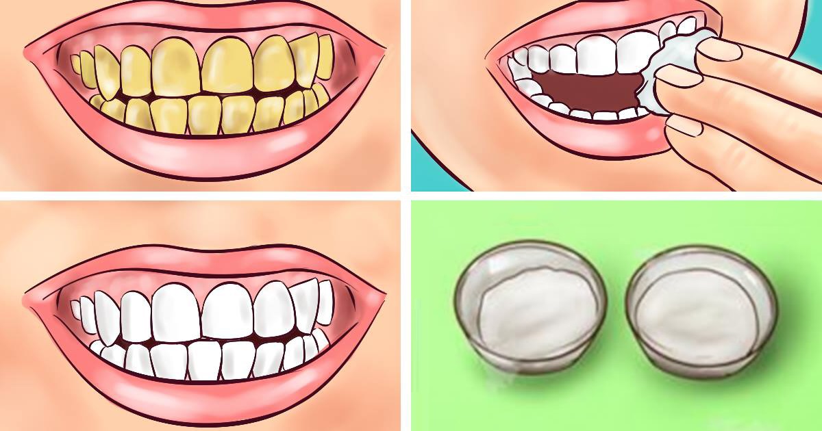 Guaranteed! Whiten Your Yellow Teeth In Less Than 2 Minutes! - Hecspot