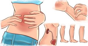Read more about the article If Your Kidney Is In Danger, The Body Will Give You These 7 Signs