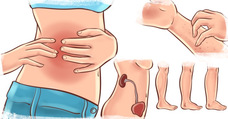 You are currently viewing If Your Kidney Is In Danger, The Body Will Give You These 7 Signs