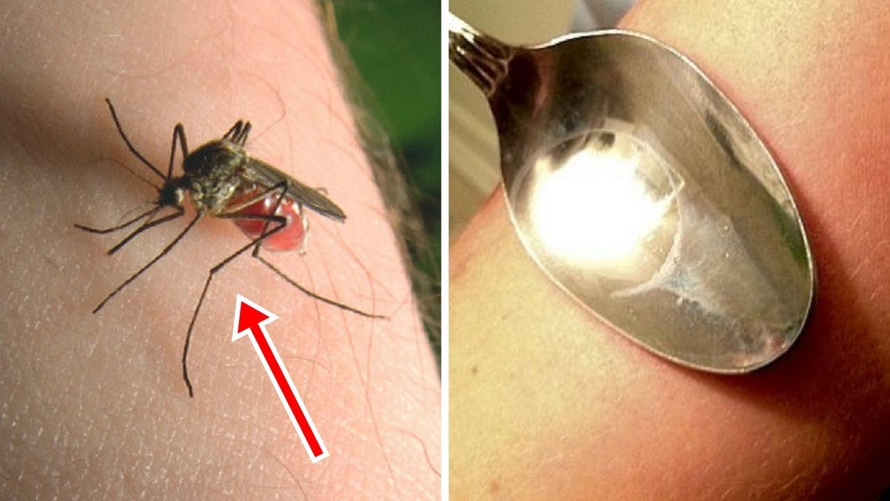 You are currently viewing 10 Tricks To Make Mosquito Bites Stop Itching That You’ll Wish You Knew Sooner