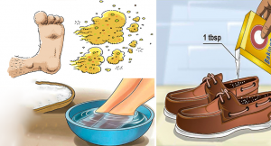 Read more about the article Put Baking Soda In Your Shoes And Say Goodbye To These Problems