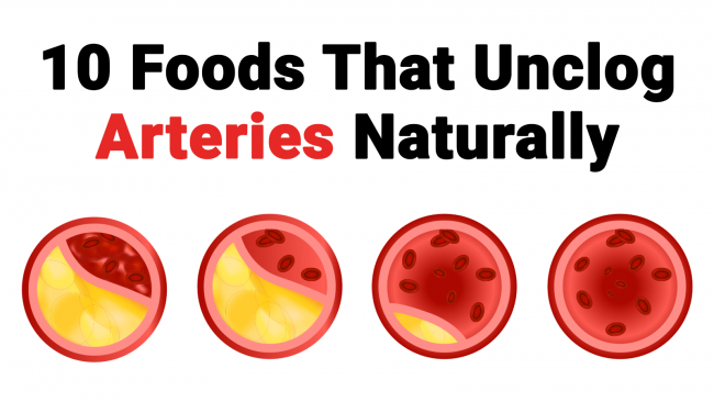 You are currently viewing 10 Foods That Unclog Arteries Naturally