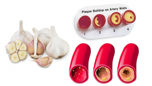 Read more about the article This Garlic Mixture Will Clean Your Blood Vessels Even Those In Your Brain