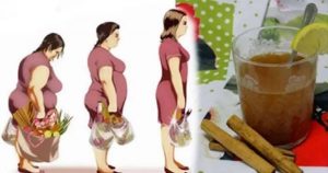 Read more about the article This Honey, Lemon, And Cinnamon Drink Will Help You Lose Pounds in One Week