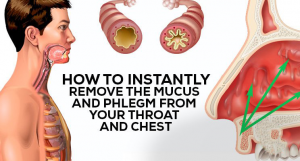 Read more about the article How to Get Rid of Phlegm and Mucus in Chest & Throat
