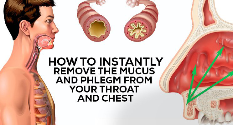 You are currently viewing How to Get Rid of Phlegm and Mucus in Chest & Throat