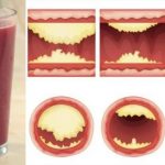 This Delicious Juice Will Unclog Arteries and Prevent Heart Disease!