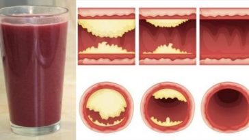 Delicious Juice Will Unclog Arteries