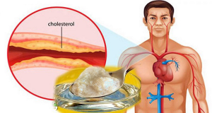 Read more about the article The Best Medicine Against Cholesterol And High Blood Pressure