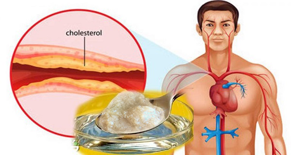 You are currently viewing The Best Medicine Against Cholesterol And High Blood Pressure