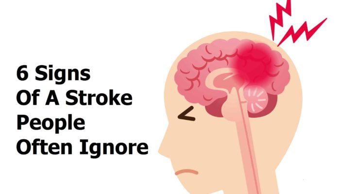 You are currently viewing 6 Signs Of A Stroke People Often Ignore