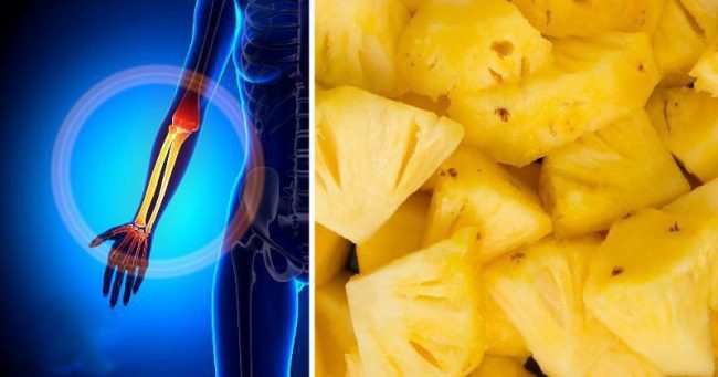 You are currently viewing 8 Reasons Why You Should Start Eating Pineapple Today!