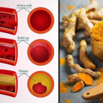 Turmeric For High Blood Pressure: How The Golden Spice Can Help