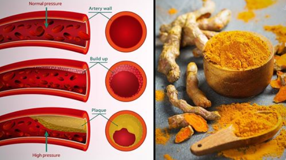 You are currently viewing Turmeric For High Blood Pressure: How The Golden Spice Can Help