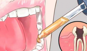 Read more about the article 12 All Natural Toothache Remedies Your Dentist Doesn’t Want You to Know About