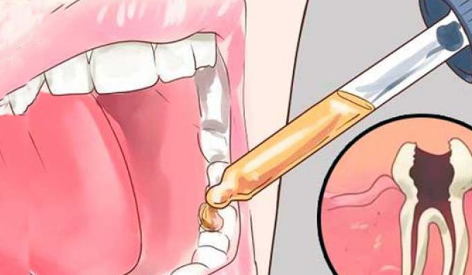 You are currently viewing 12 All Natural Toothache Remedies Your Dentist Doesn’t Want You to Know About
