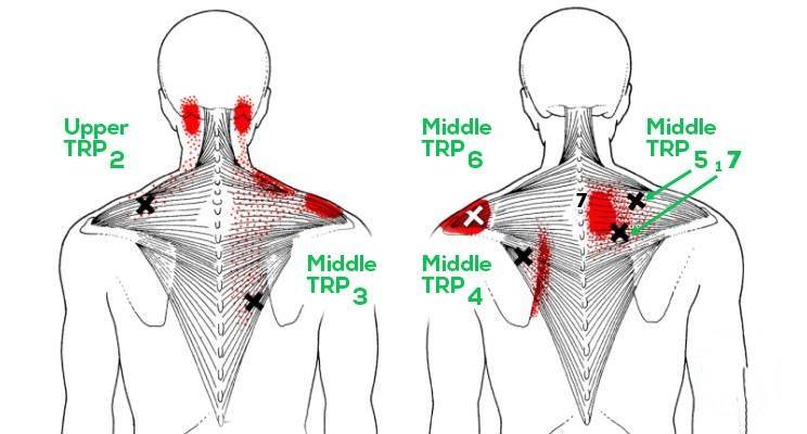 You are currently viewing Try These 15 Stretches to Relieve a Stiff Neck, Tight Shoulders And Upper Back Pain!