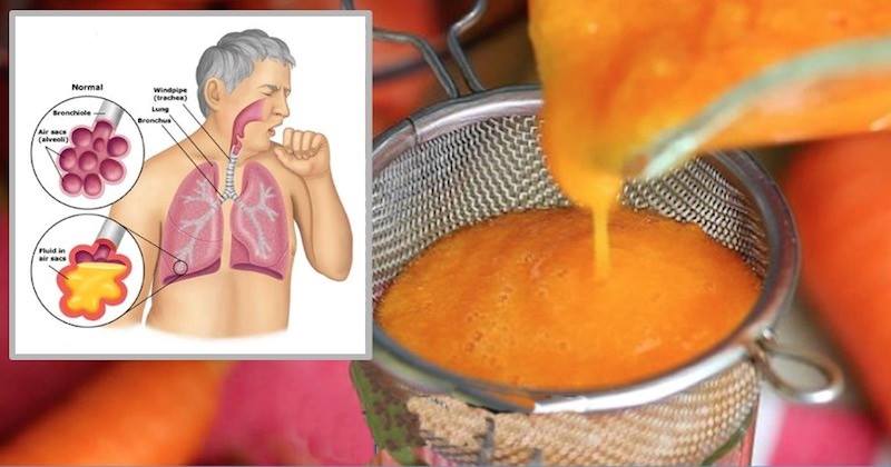 You are currently viewing 2-Ingredient Homemade Syrup For Stopping Cough And Clearing Phlegm From Lungs