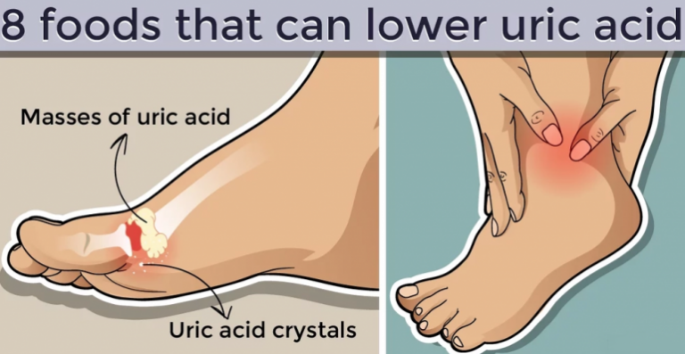You are currently viewing 8 Foods That Can Lower Uric Acid