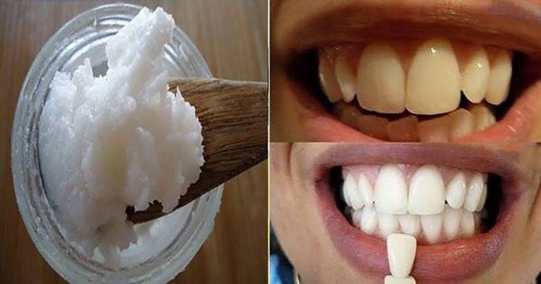 You are currently viewing Say Goodbye To Bad Breath, Plaque, Tartar And Kill Harmful Bacteria In Your Mouth With Only One Ingredient