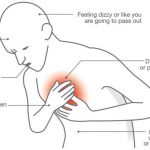 Know When It’s A Cardiac Arrest + 8 Symptoms And Tips To Recovery