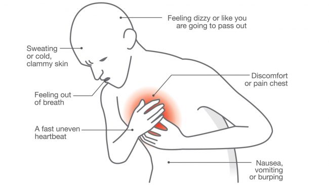 You are currently viewing Know When It’s A Cardiac Arrest + 8 Symptoms And Tips To Recovery