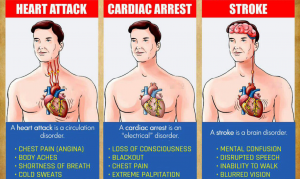 Read more about the article You Must Know The Differences Between A Heart Attack, Cardiac Arrest And Stroke