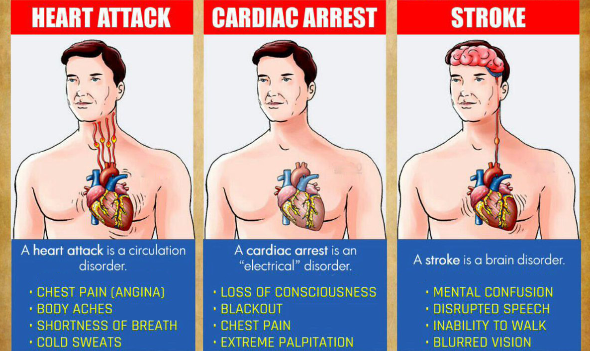 You are currently viewing You Must Know The Differences Between A Heart Attack, Cardiac Arrest And Stroke