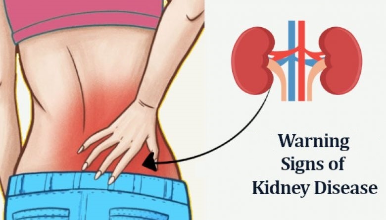 You are currently viewing 25 Hidden Signs You Have Kidney Problems. This is Lifesaving