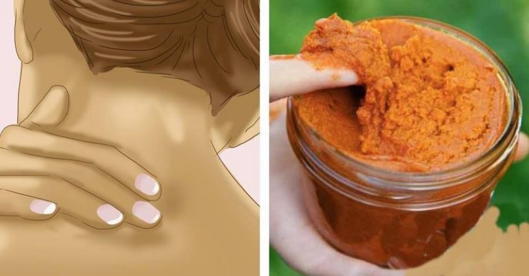 You are currently viewing Homemade Muscle Rub Recipe With Turmeric, Coconut Oil And Cayenne Pepper For Quick Relief