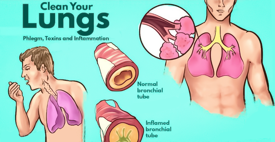 You are currently viewing How to Get Rid of Phlegm and Mucus in Chest & Throat (Instant Result)