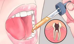 Read more about the article Put This In Your Mouth And That Frustrating Toothache Will Disappear In A Few Seconds