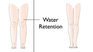 Read more about the article 5 Reasons Your Body Retains Water & How to Avoid It