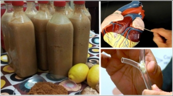You are currently viewing Reduce Cholesterol And Clean All Blood Vessels Up to The Heart With This Natural Remedy