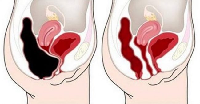 You are currently viewing How To Remove Waste From Your Colon Quickly and Safely – Recipe
