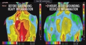 Read more about the article How To Reduce Inflammation In Your Body, Re-Energize, And Improve Your Blood Pressure At Zero Cost