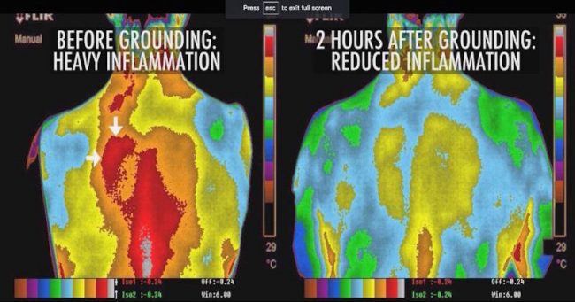 You are currently viewing How To Reduce Inflammation In Your Body, Re-Energize, And Improve Your Blood Pressure At Zero Cost