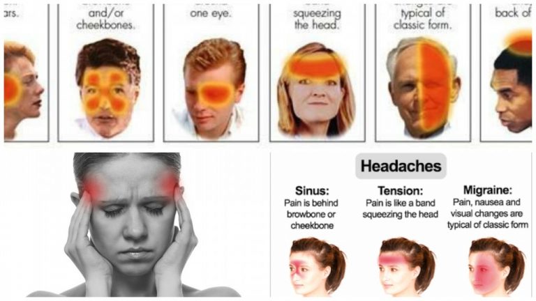 You are currently viewing 6 Different Types Of Headaches (Signs And How To Recognize)