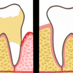 Dentists Explain 7 Habits That Ruin Your Teeth and Gums (And How to Fix Them)