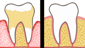 Read more about the article Dentists Explain 7 Habits That Ruin Your Teeth and Gums (And How to Fix Them)