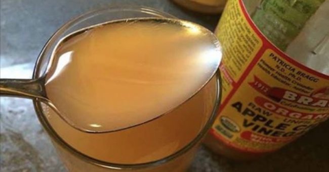 You are currently viewing 1 Tablespoon Of Apple Cider Vinegar A Day For 60 Days Can Eliminate All These Health Problems!