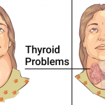 11 Foods That Significantly Improve Your Thyroid Health and Help You Treat Thyroid Problems