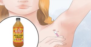 Read more about the article 7 Easy Ways to Remove Skin Tags Without Seeing a Doctor