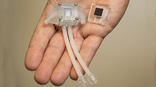 You are currently viewing This Artificial Kidney Could Eliminate The Need For Kidney Dialysis