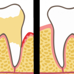 Dentists Explain 7 Habits That Ruin Your Teeth and Gums (And How to Fix It)