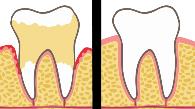 You are currently viewing Dentists Explain 7 Habits That Ruin Your Teeth and Gums (And How to Fix It)